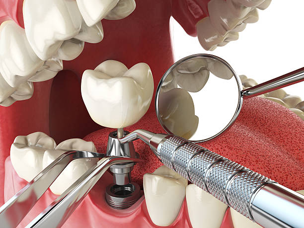 Best Emergency Root Canal Treatment in Mmaduke, AR